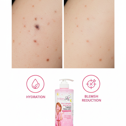 Before and after skin lightening results