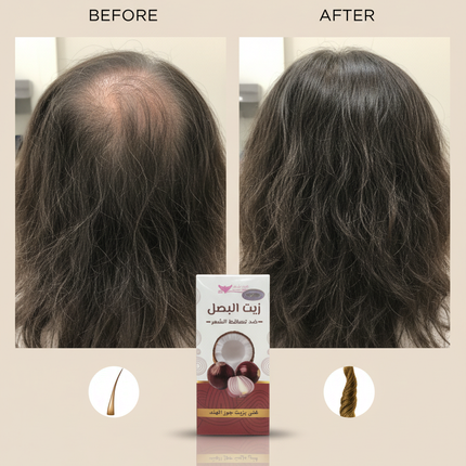 Onion Oil Before/After