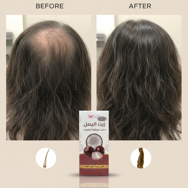 Onion Oil Before/After